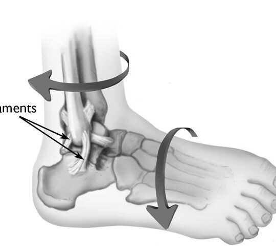 Soft tissue injuries